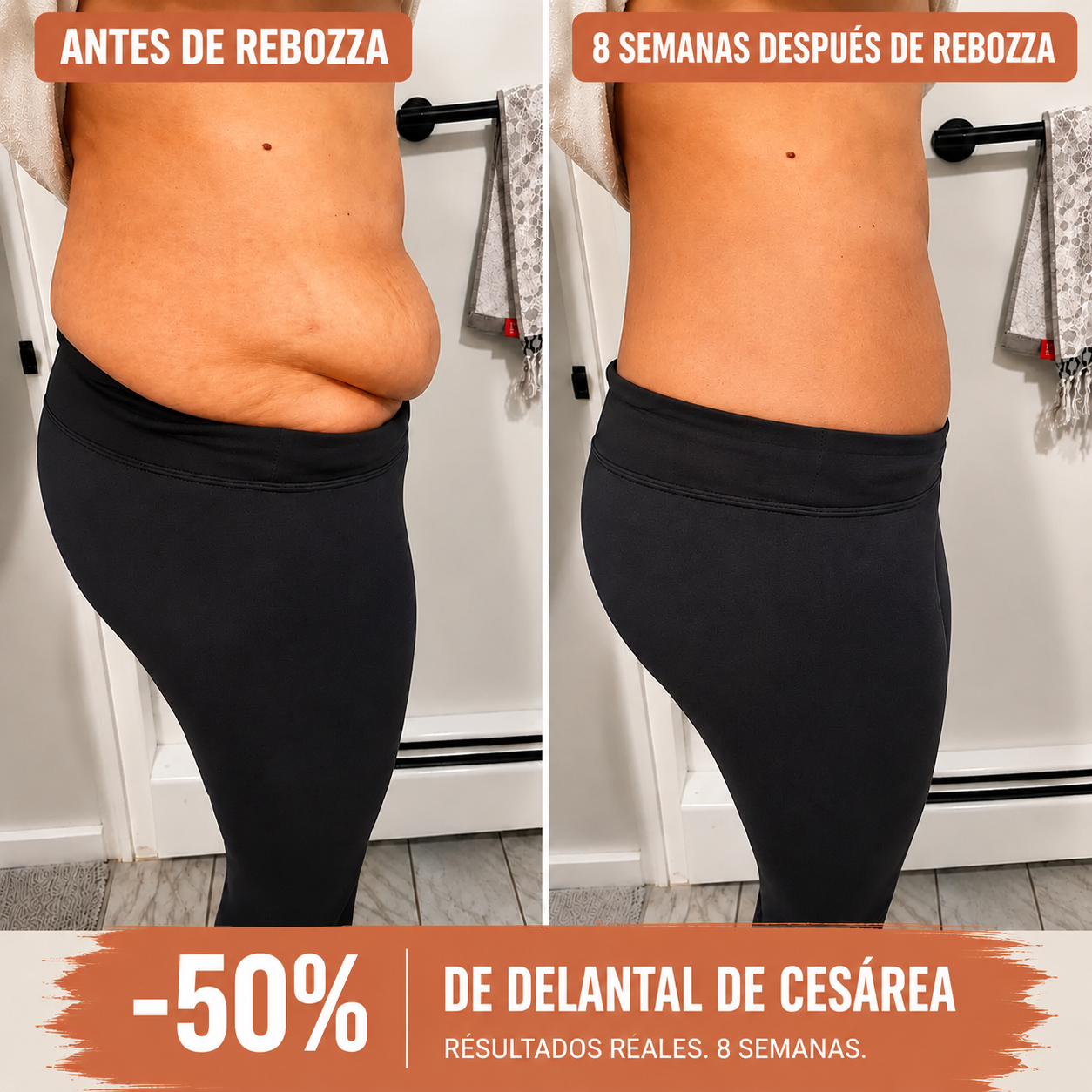 Avant après césarienne